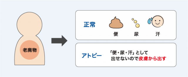 正常な人とアトピーの人の老廃物の出し方の違い